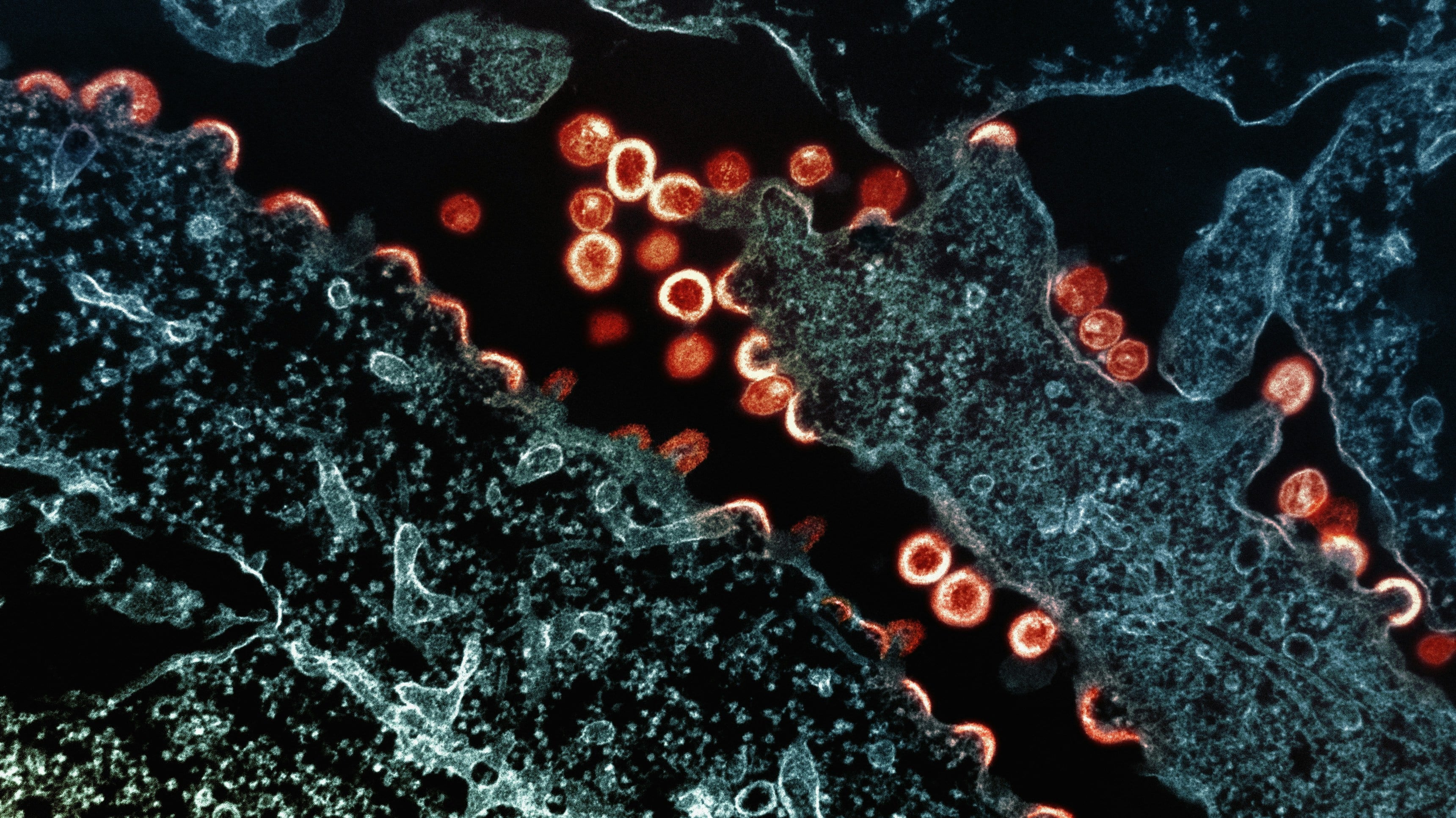 Biosolution